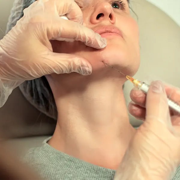 Img-clinica-estetica-bogota-Servicio-Acido_hialurónico