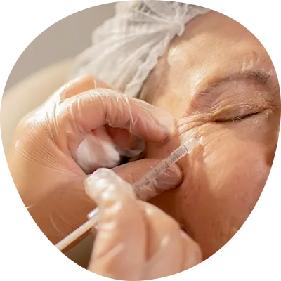 img-botox-en-bogota-1-LCP